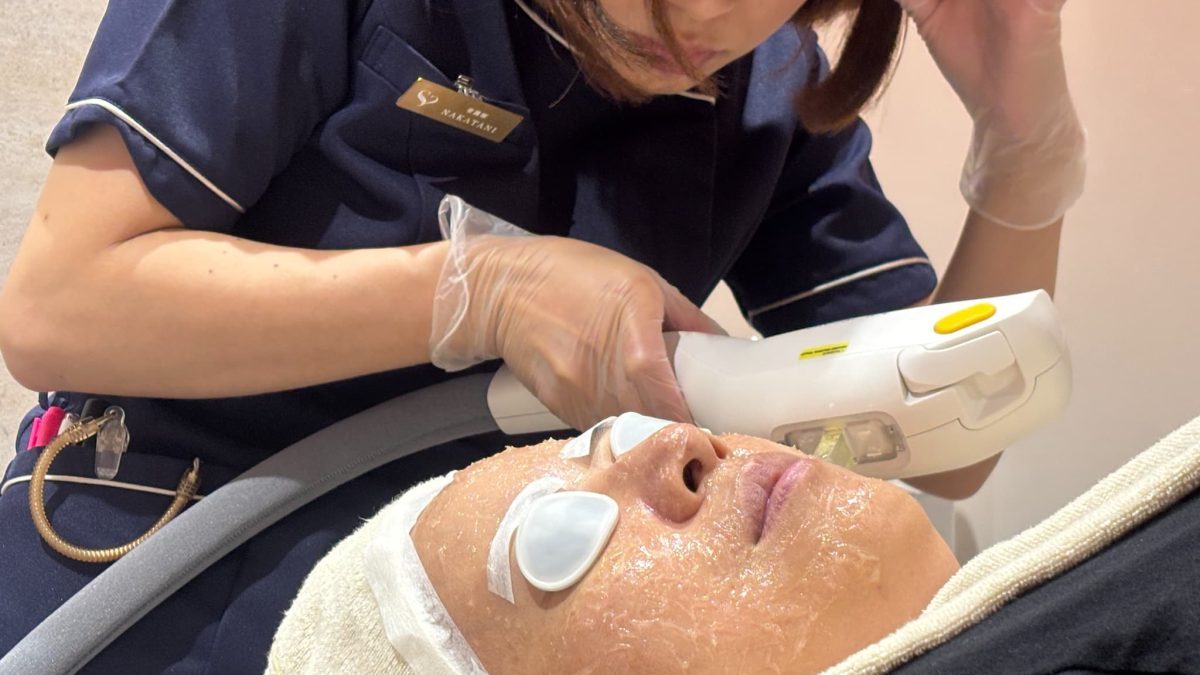 フォトフェイシャル