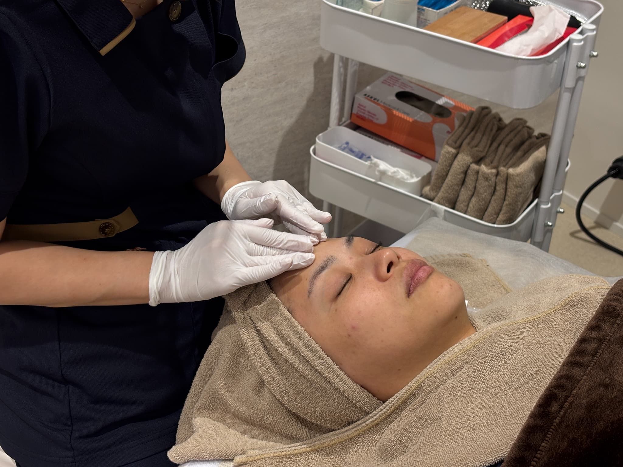 ニキビ・毛穴・くすみ改善の切り札！ケミカルピーリング完全ガイド