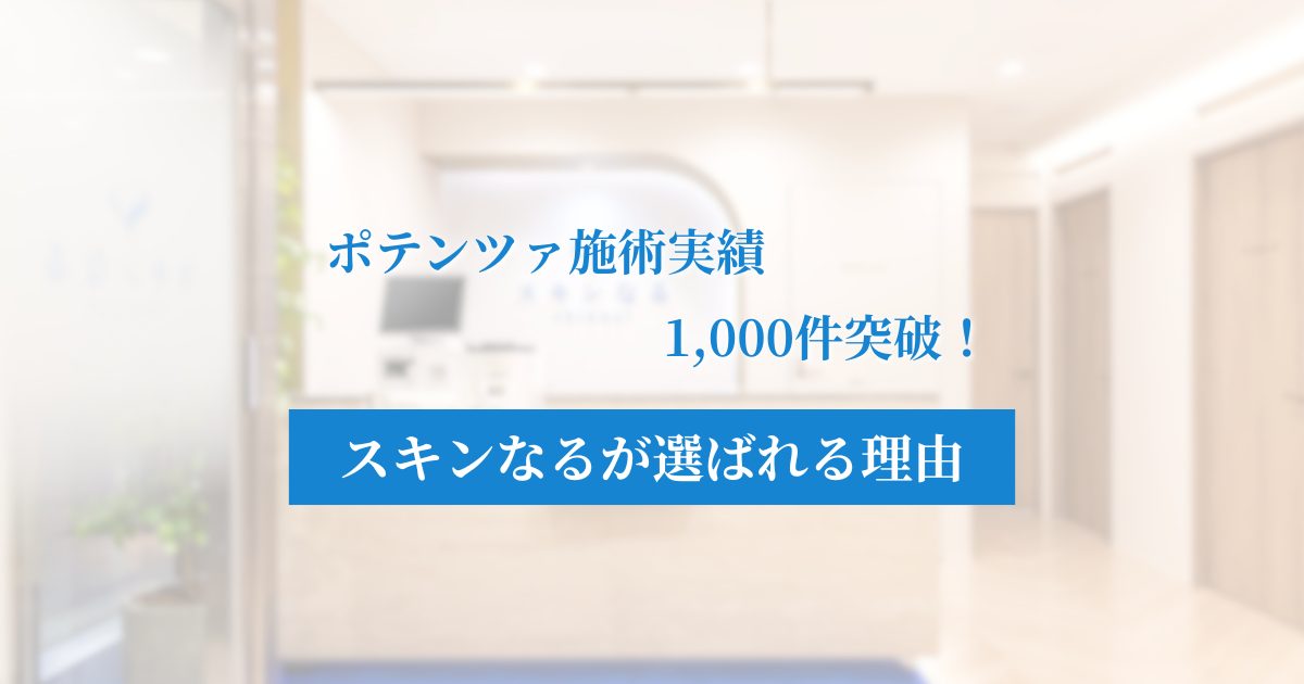 効果と安心にこだわるスキンなるのポテンツァ！選ばれる5つの理由を解説！