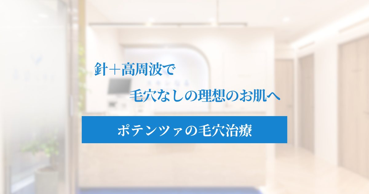ポテンツァで毛穴レスへ！毛穴治療に聞くメカニズムやダーマペンとの違いを解説