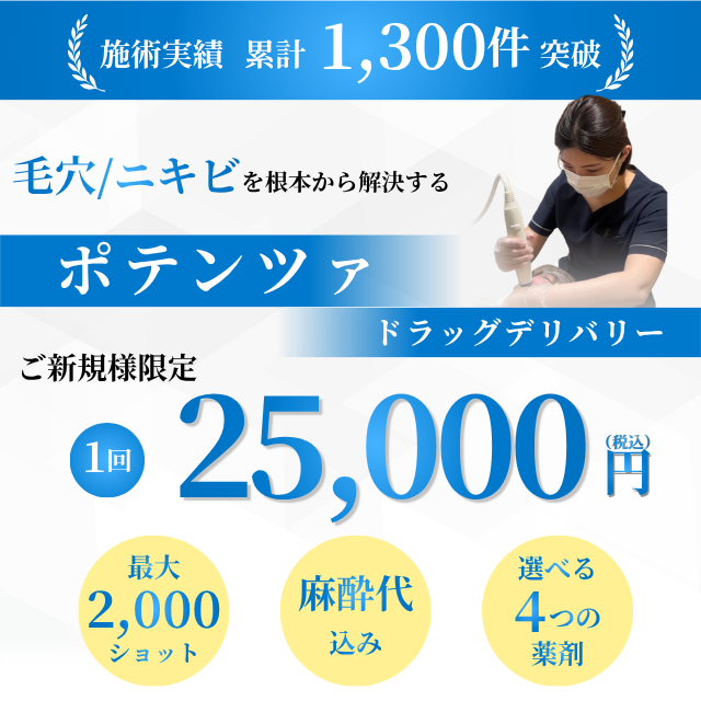 ポテンツァ