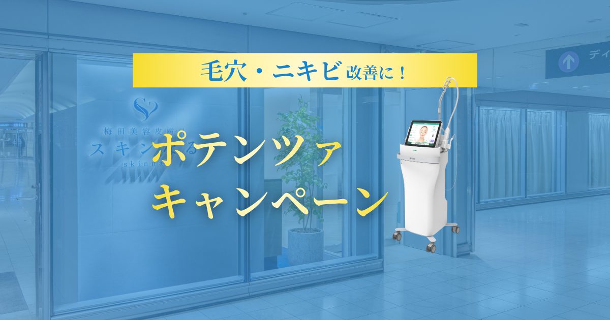 毛穴・ニキビを根本から解決!ポテンツァキャンペーン