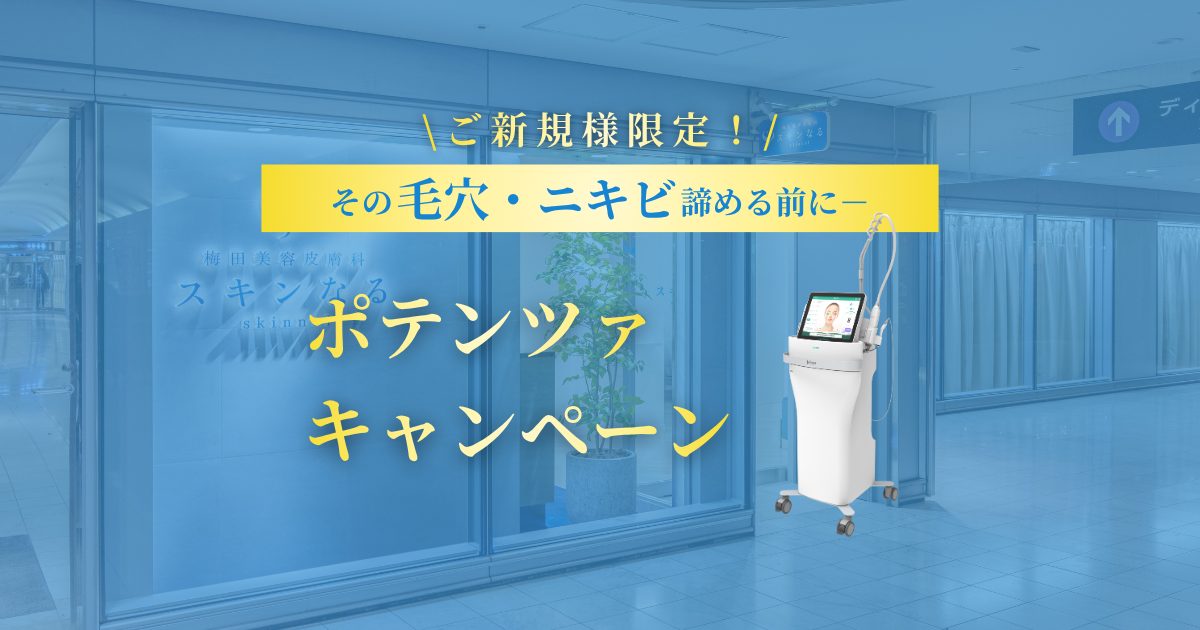 毛穴・ニキビを根本から解決！ポテンツァキャンペーン