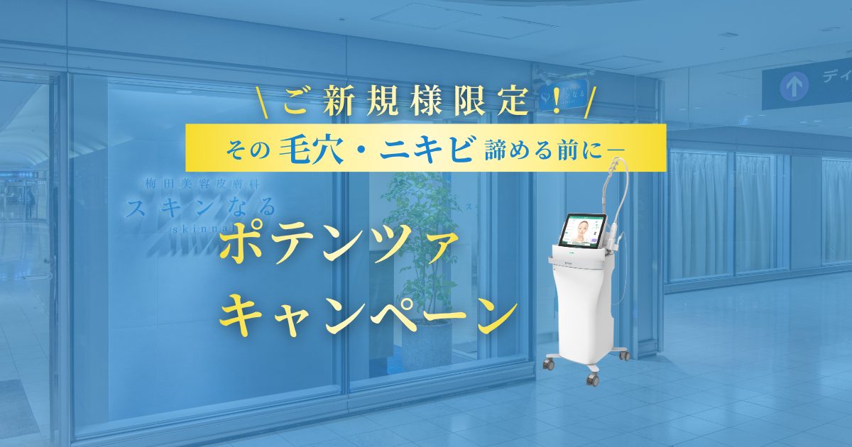 毛穴・ニキビを根本から解決!ポテンツァキャンペーン