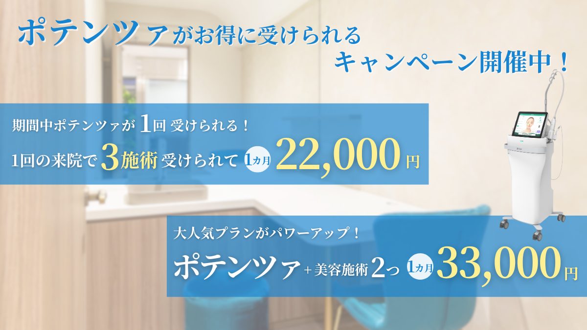 ポテンツァがお得に受けられるキャンペーンについてまとめた画像