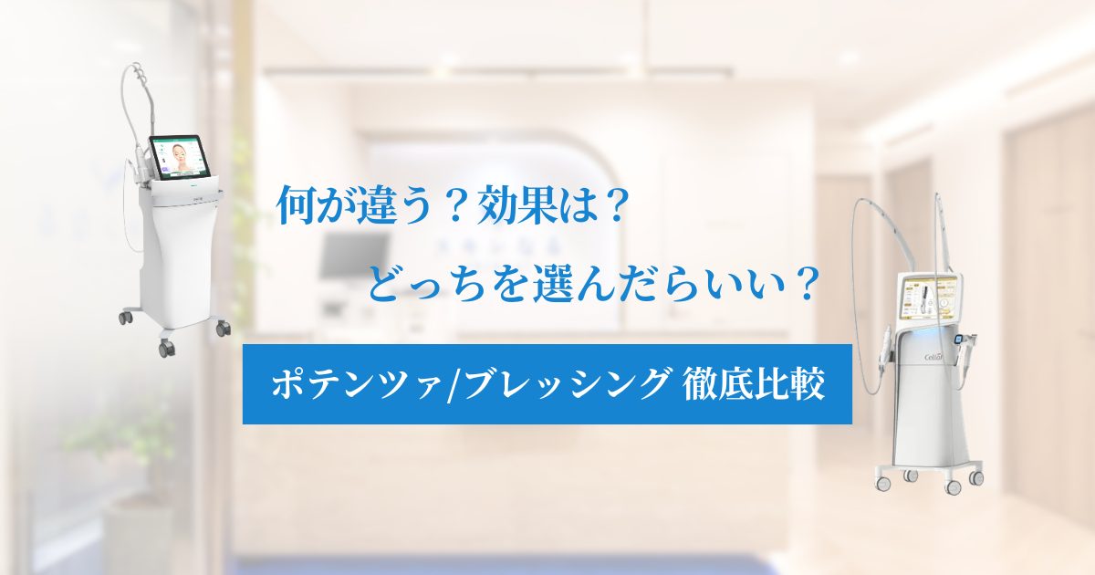 ポテンツァとブレッシングの違いとお悩み別の選び方を徹底解説!