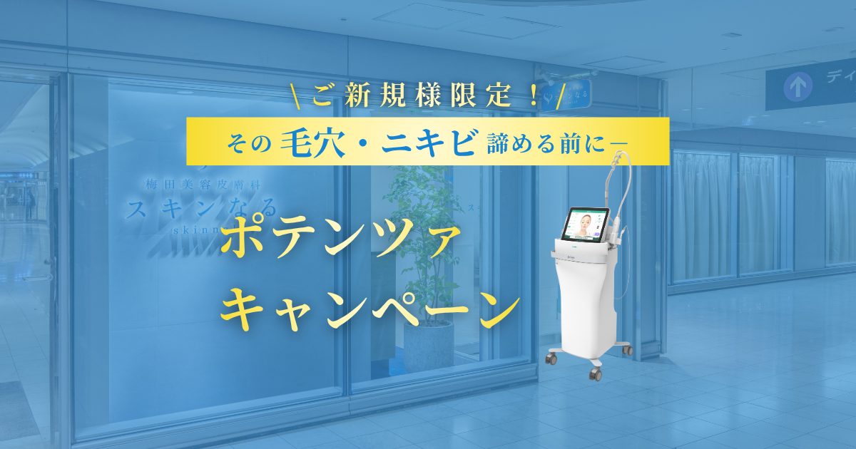 毛穴・ニキビを根本から解決！ポテンツァキャンペーン