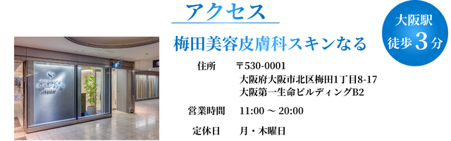 大阪・梅田のお得なポテンツァキャンペーン