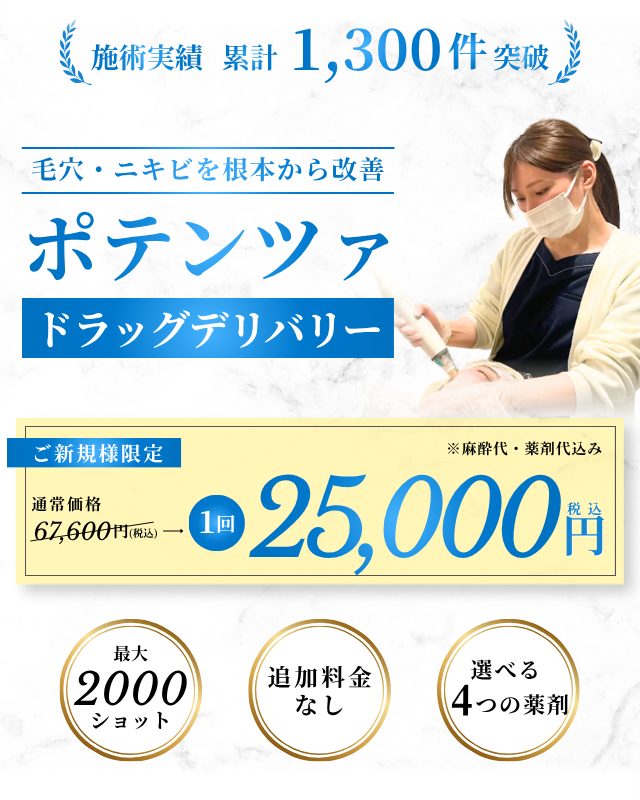 大阪・梅田のお得なポテンツァキャンペーン